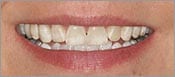 patient_claudia_before_teeth